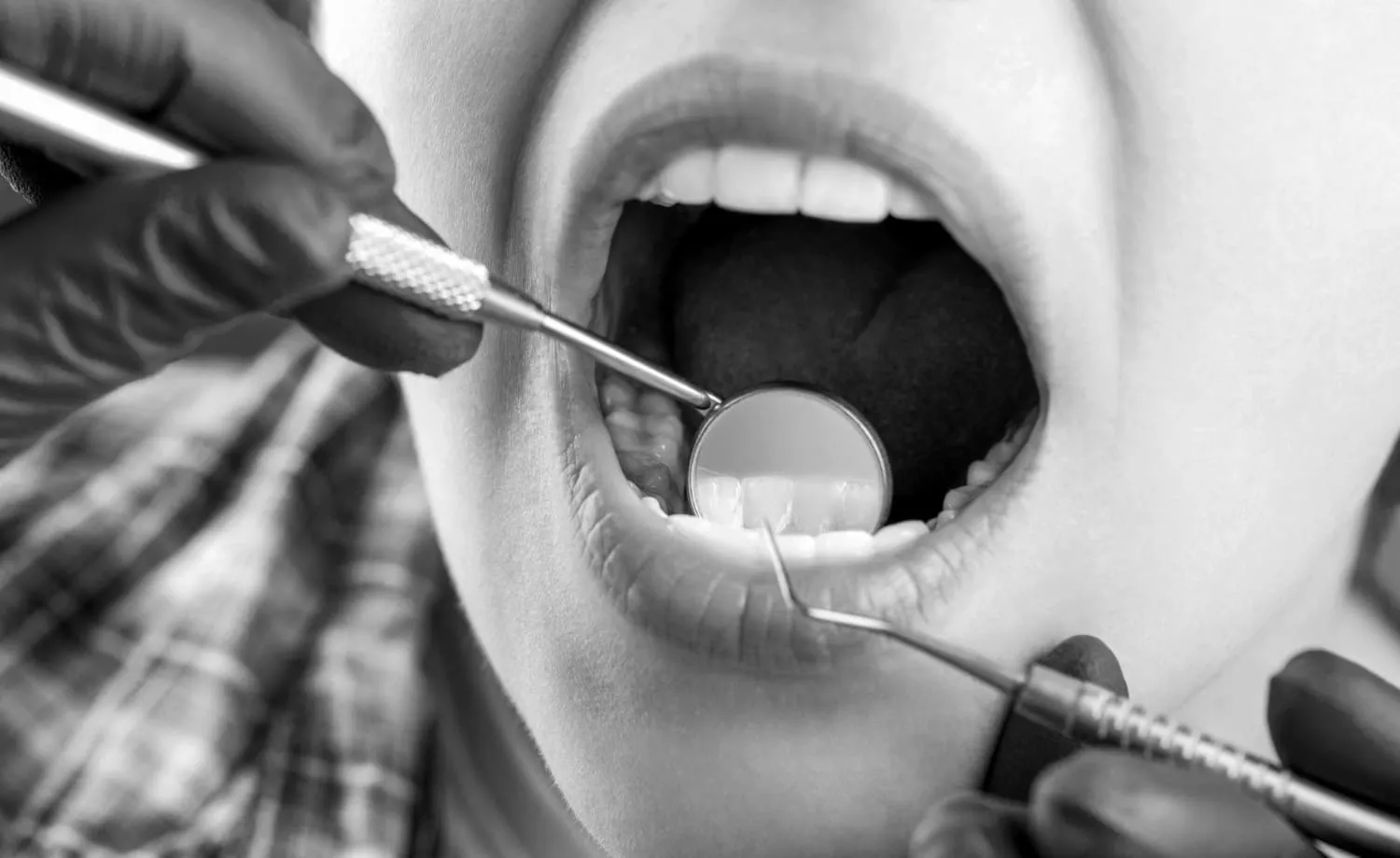 periodoncia en vigo