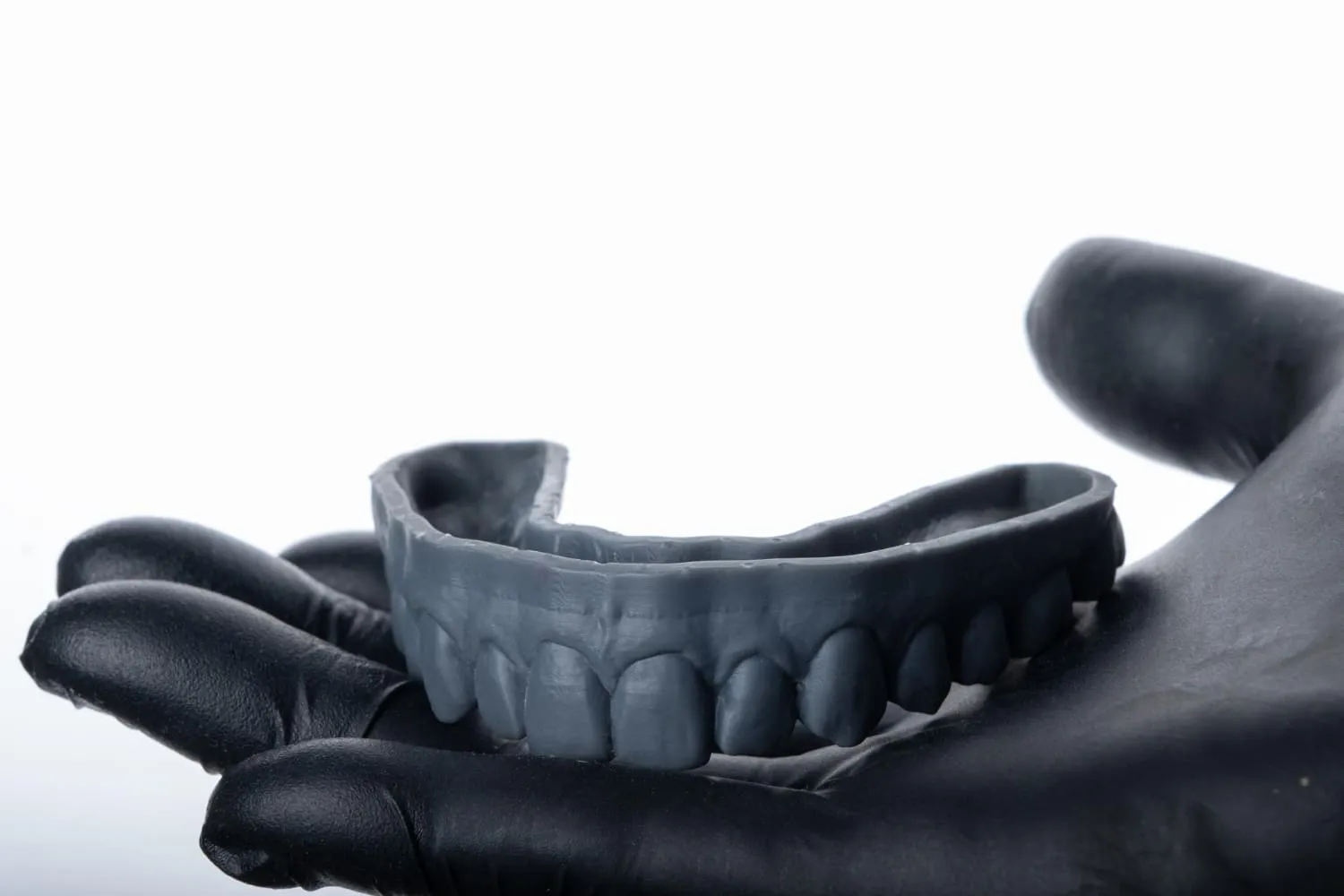 prótesis dentales en vigo