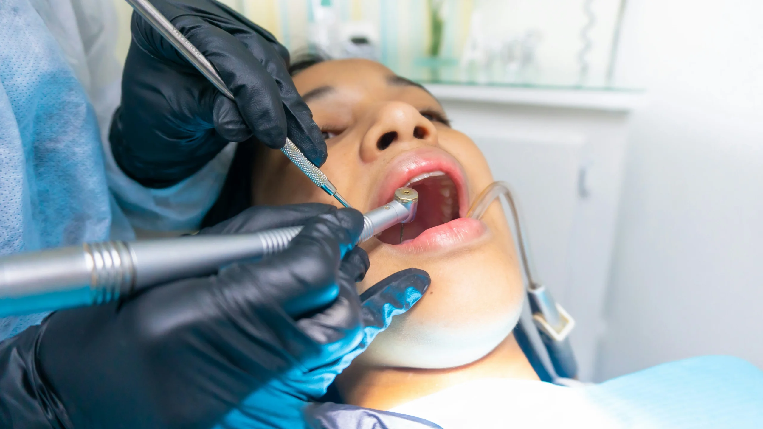 paciente con la boca abierta, siendo atendida de urgencia dental